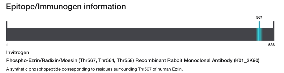 Phospho-Ezrin/Radixin/Moesin (Thr567, Thr564, Thr558) Recombinant Rabbit Monoclonal Antibody (K01_2K90)