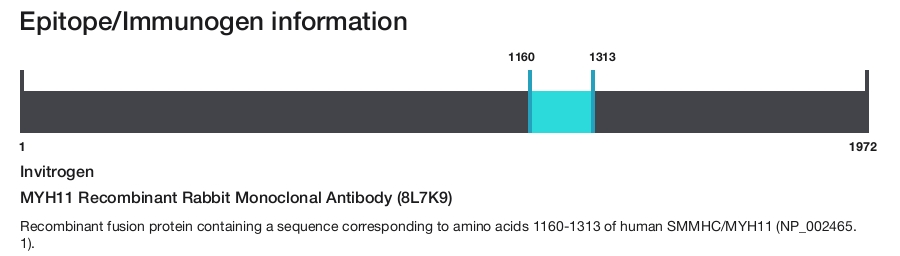 MYH11 Recombinant Rabbit Monoclonal Antibody (8L7K9)