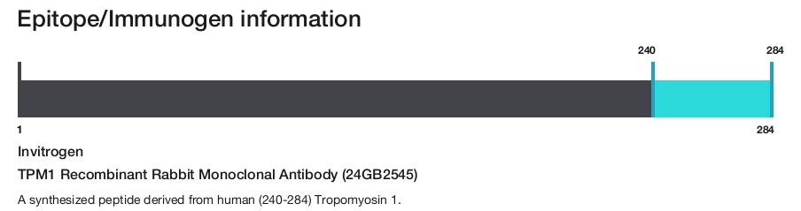 TPM1 Recombinant Rabbit Monoclonal Antibody (24GB2545)