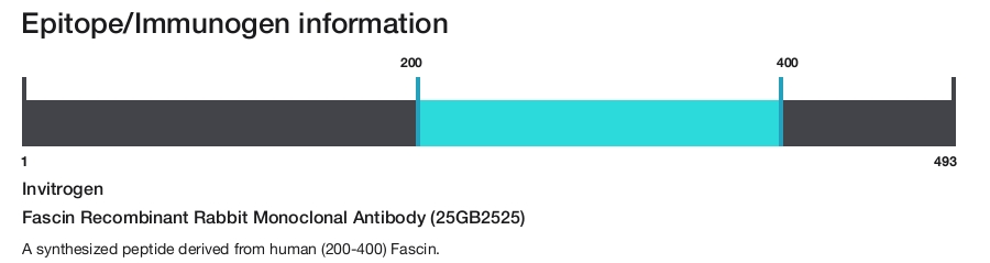 Fascin Recombinant Rabbit Monoclonal Antibody (25GB2525)
