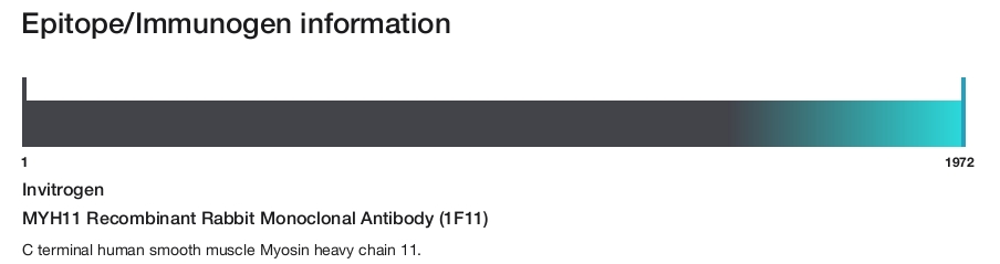 MYH11 Recombinant Rabbit Monoclonal Antibody (1F11)