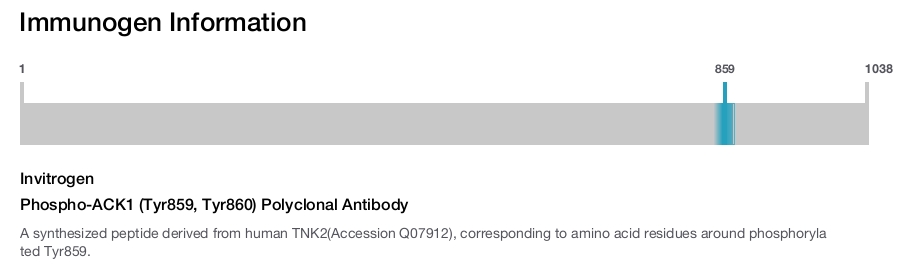 Phospho-ACK1 (Tyr859, Tyr860) Polyclonal Antibody