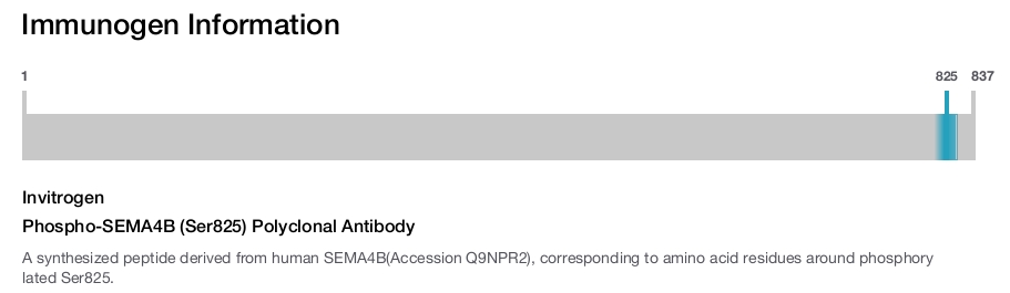 Phospho-SEMA4B (Ser825) Polyclonal Antibody
