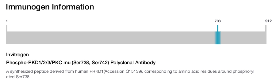 Phospho-PKD1/2/3/PKC mu (Ser738, Ser742) Polyclonal Antibody