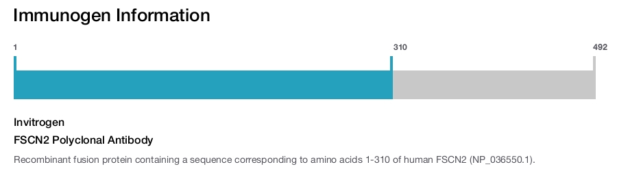 FSCN2 Polyclonal Antibody