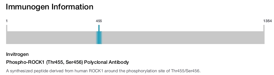 Phospho-ROCK1 (Thr455, Ser456) Polyclonal Antibody