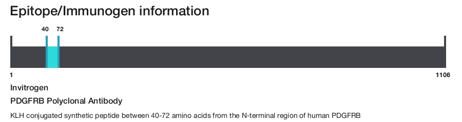 PDGFRB Polyclonal Antibody