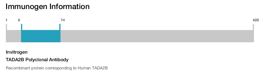 TADA2B Polyclonal Antibody