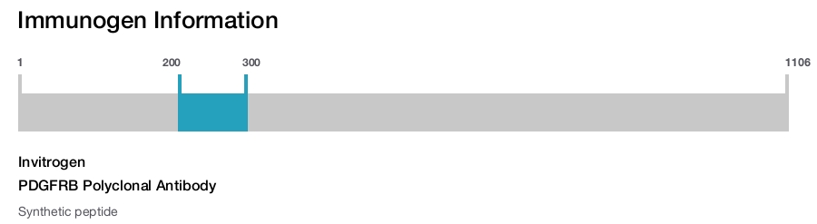 PDGFRB Polyclonal Antibody