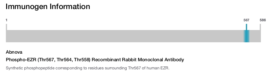 Phospho-EZR (Thr567, Thr564, Thr558) Recombinant Rabbit Monoclonal Antibody