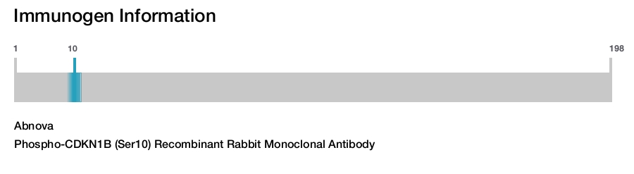 Phospho-CDKN1B (Ser10) Recombinant Rabbit Monoclonal Antibody