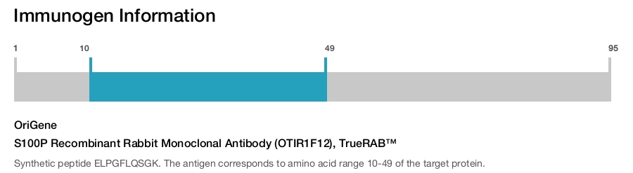 S100P Recombinant Rabbit Monoclonal Antibody (OTIR1F12), TrueRAB&trade;
