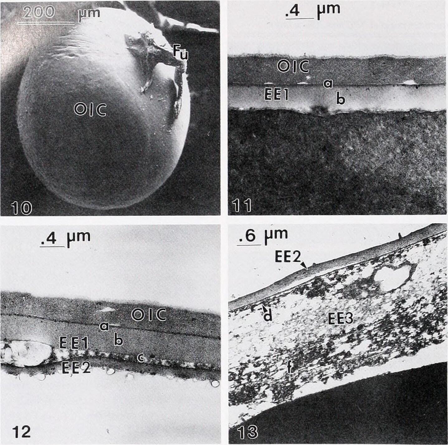 TEM image of grass shrimp embryo
