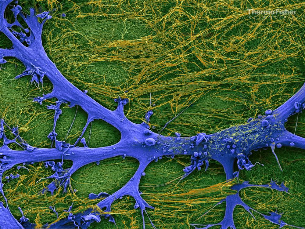 Brain cell image obtained with electron microscopy