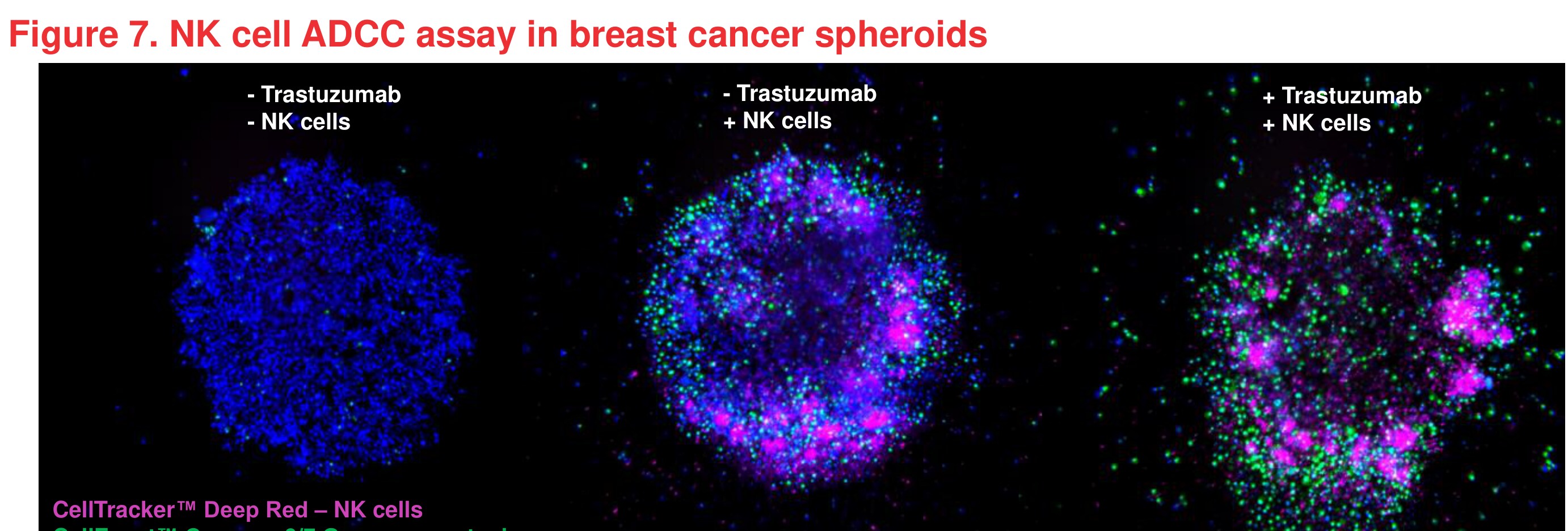 Figure 7 NK cell ADCC assay in breast cancer spheroids