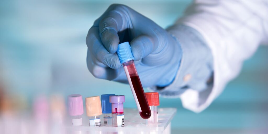 Cutting-Edge Triple Quad ICP-MS for Clinical Trace Element Analysis