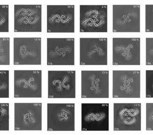 Cryo-EM tau protein structure studies unravel neurodegenerative disease mysteries