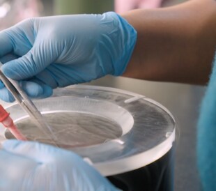 The study of mitochondrial dysfunction at Scripps Research Institute