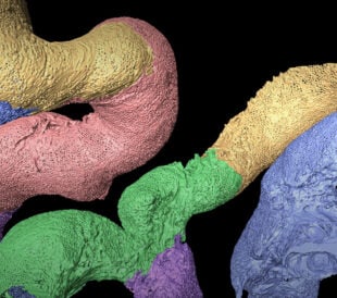 glomerular diseases research into 3D architecture of glomerular endothelial cells (GEnCs) from adult rats