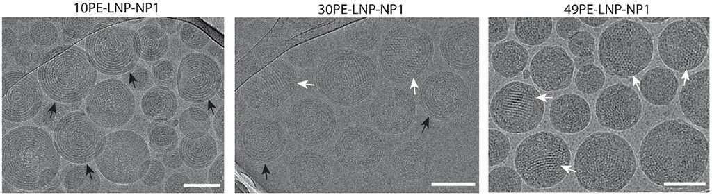 Different LNPs visualized with cryo-TEM.