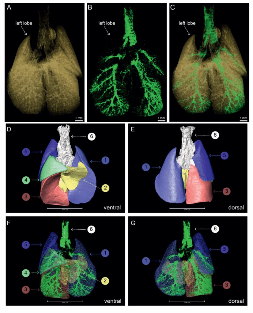 Particle distribution determined with 3D lung analysis.