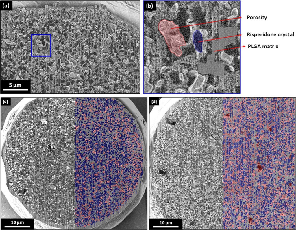 Risperidone-loaded PLGA microparticles analyzed with FIB SEM and EDS.