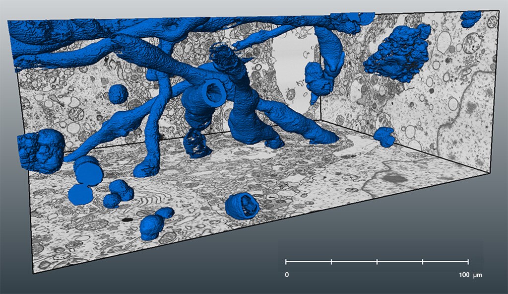 Postmortem brain tissue imaging with FIB SEM volume EM, showing myelin, mitochondria, and the nucleus.