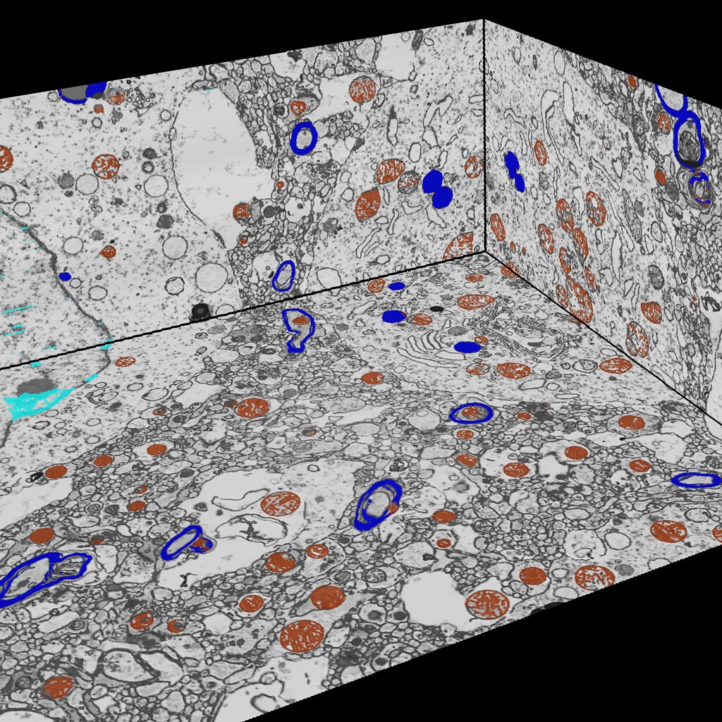 Postmortem brain tissue imaging with FIB SEM volume EM, showing myelin, mitochondria, and the nucleus.