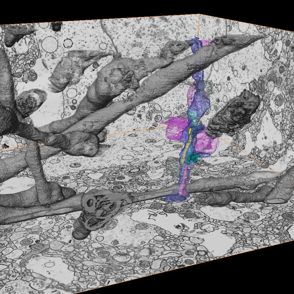 Postmortem brain tissue imaging and reconstruction with FIB SEM volume EM shows a dendritic shaft.