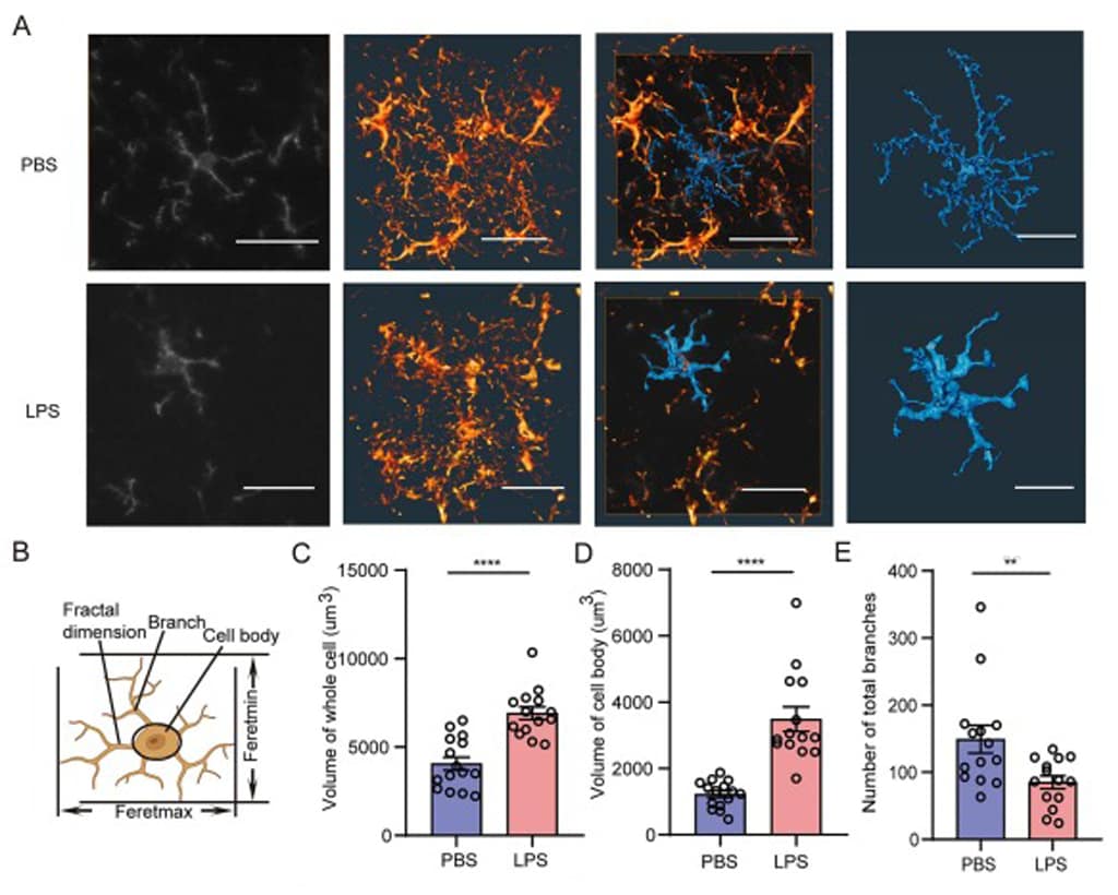 Microglia structure determined with 3D tissue histology, leveraging light sheet microscopy and Amira Software. Critical parameters obtained with Amira Software analysis are shown as histograms.