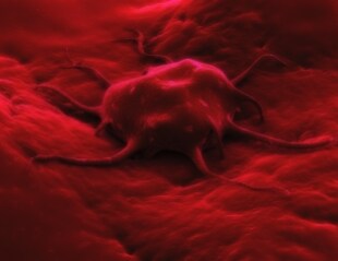 microscope view of cancer cell