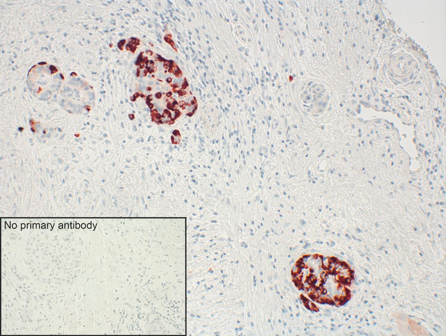no primary antibody added