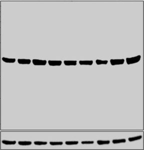 western blot and polyclonal antibody