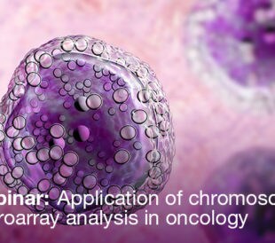 banner image for webinar Application of Chromosomal Microarray Analysis in Oncology