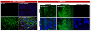 Immunohistochemical analysis of Parkin