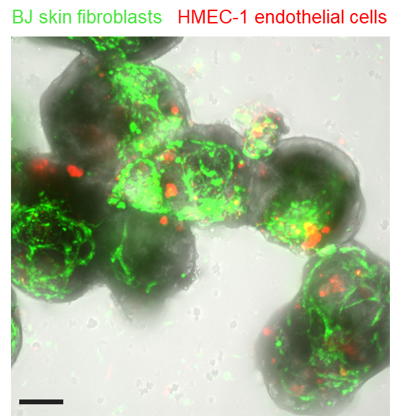 Cancer organoid co-culture