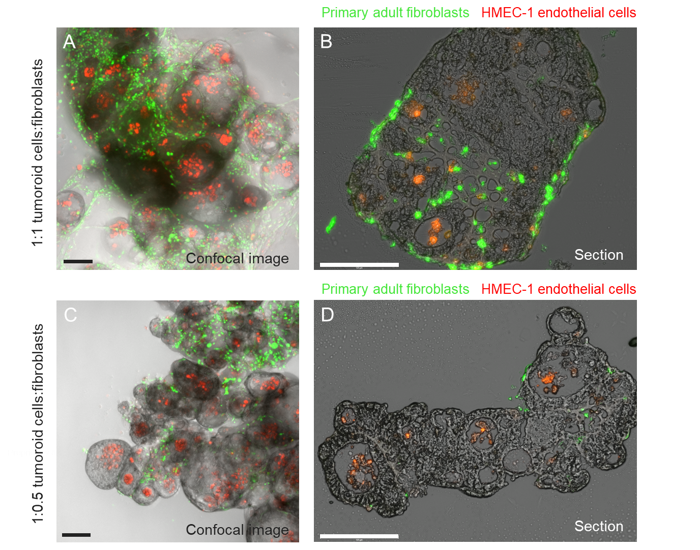 Localization in cancer organoid co-culture