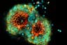 Cancer organoids vs cancer spheroids