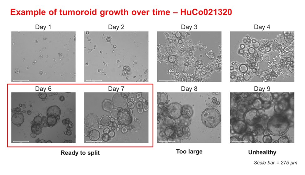 Time course images of HuCo021320 colorectal tumoroid growth in OncoPro Tumoroid Culture Medium