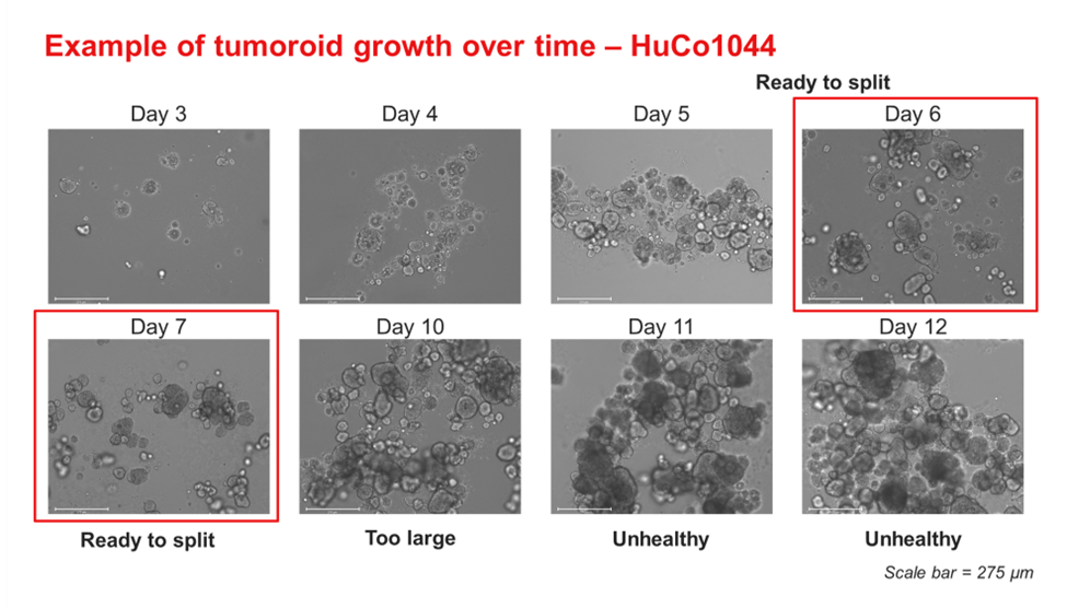 Time course images of HuCo1044 colorectal tumoroid growth in OncoPro Tumoroid Culture Medium