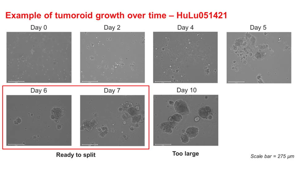 Time course images of HuLu051421 lung tumoroid growth in OncoPro Tumoroid Culture Medium