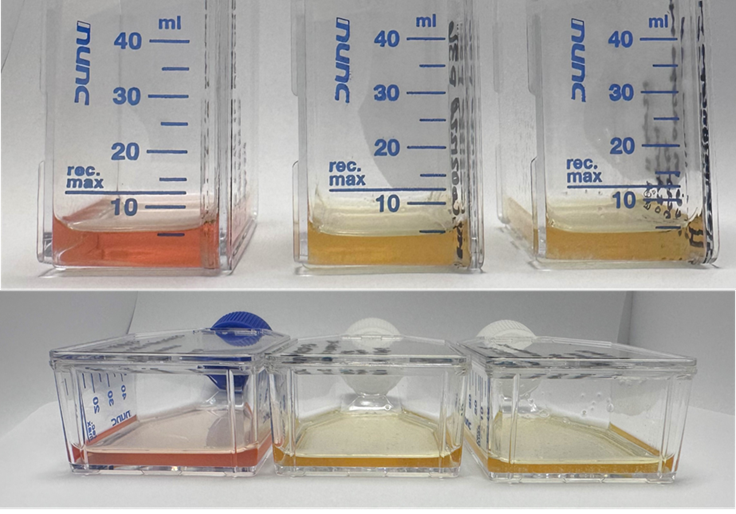 Examples of media color in tumoroid cultures