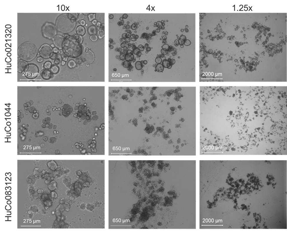 Examples of media color in tumoroid cultures