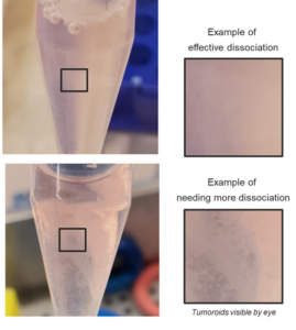 Images of conical tubes containing effectively dissociated tumoroids (top) and tumoroids needing additional incubation time in StemPro Accutase (bottom).