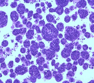 Microscopic image of HuLu051921 tumoroids stained with Hematoxylin and Eosin at 20x magnification, field 1, bottom section of the slide