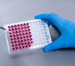Scientist pipetting into a 96 well plate during qPCR workflow for cell free DNA fragmentomics analysis