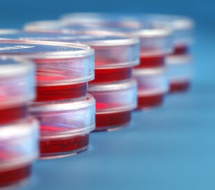 Biological cultures.