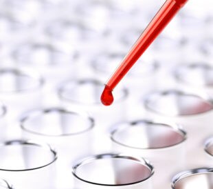 Pipetting blood samples into a deep-well plate. Image: maxuser/Shutterstock.com