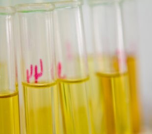 Urine samples. Image by jannoon028/Shutterstock.com