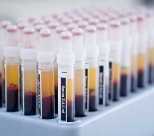 Serum samples. Image: Bajars/Shutterstock.com